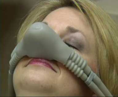 A woman breathes in nitrous oxide through a nose mask. Nitrous oxide is used to treat mild dental anxiety.